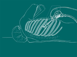 colorectal