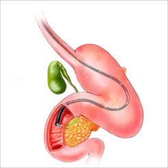 illustration-how-to