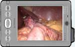 WebSurg in your pocket