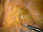 Videos of live surgery